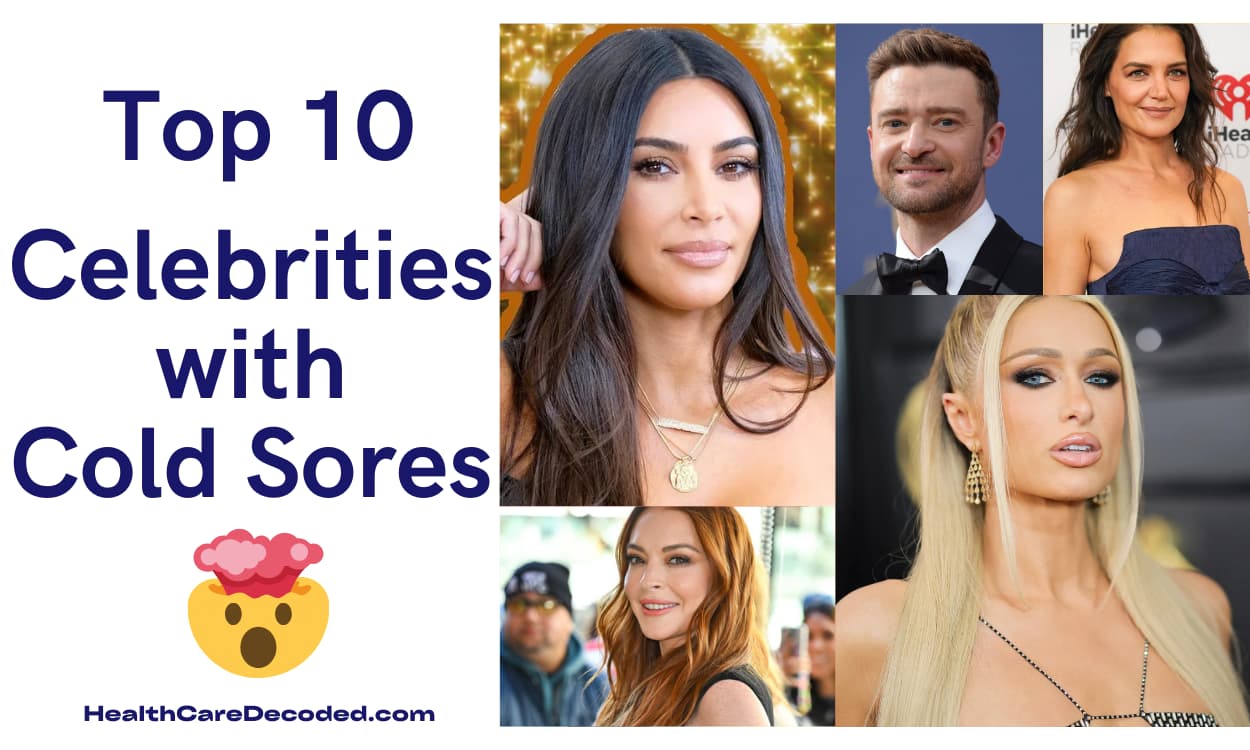 Celebrities with Cold Sores
